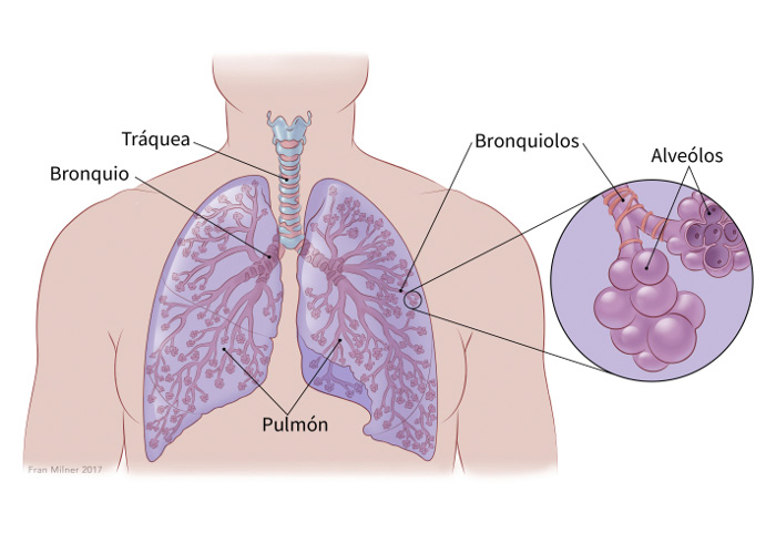 cancer pulmon